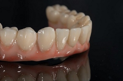 1629362166592922.jpg 案例500.jpg